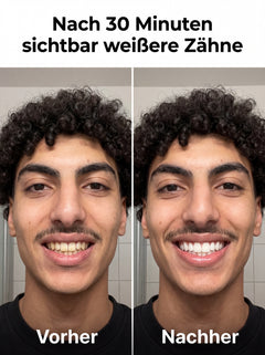 Sichtbar weißere Zähne in nur 30 Minuten  – ohne Zahnarzt